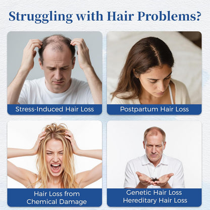 Rosemary Hair Growth Serum